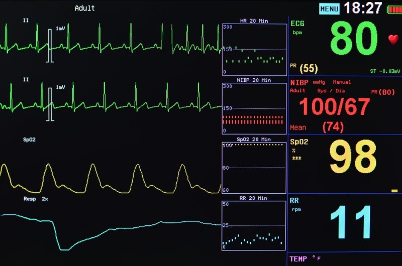 Hospital Monitoring Equipment